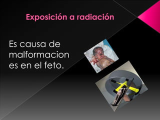 Exposición a radiaciónEs causa de malformaciones en el feto.