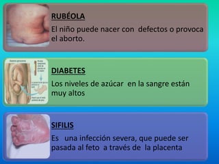 RUBÉOLA
El niño puede nacer con defectos o provoca
el aborto.
DIABETES
Los niveles de azúcar en la sangre están
muy altos
SIFILIS
Es una infección severa, que puede ser
pasada al feto a través de la placenta
 