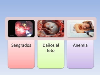 Sangrados Daños al
feto
Anemia
 