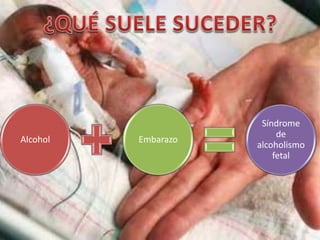 Alcohol Embarazo
Síndrome
de
alcoholismo
fetal
 