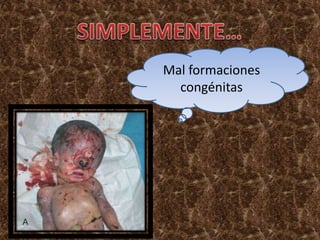 Mal formaciones
congénitas
 