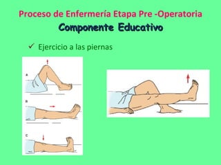 Proceso de Enfermería Etapa Pre -Operatoria Componente Educativo Ejercicio a las piernas 