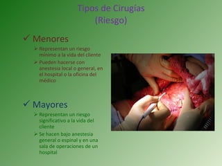 Tipos de Cirugías (Riesgo) Menores  Representan un riesgo mínimo a la vida del cliente Pueden hacerse con anestesia local o general, en el hospital o la oficina del médico Mayores Representan un riesgo significativo a la vida del cliente Se hacen bajo anestesia general o espinal y en una sala de operaciones de un hospital 