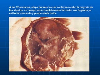 A las 12 semanas, etapa durante la cual se llevan a cabo la mayoría de los abortos, su cuerpo está completamente formado, sus órganos ya están funcionando y puede sentir dolor. 