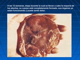 A las 12 semanas, etapa durante la cual se llevan a cabo la mayoría de
los abortos, su cuerpo está completamente formado, sus órganos ya
están funcionando y puede sentir dolor.
 