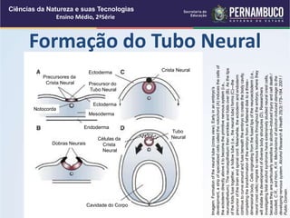 Formação do Tubo Neural
Ciências da Natureza e suas Tecnologias
Ensino Médio, 2ªSérie
Imagem:
Formation
of
the
neural
tube
(cross
view).
Early
in
an
embryo’s
development,
a
strip
of
specialized
cells
called
the
notochord
(A)
induces
the
cells
of
the
ectoderm
directly
above
it
to
become
the
primitive
nervous
system
(i.e.,
neuroepithelium).
The
neuroepithelium
then
wrinkles
and
folds
over
(B).
As
the
tips
of
the
folds
fuse
together,
a
hollow
tube
(i.e.,
the
neural
tube)
forms
(C)—the
precursor
of
the
brain
and
spinal
cord.
Meanwhile,
the
ectoderm
and
endoderm
continue
to
curve
around
and
fuse
beneath
the
embryo
to
create
the
body
cavity,
completing
the
transformation
of
the
embryo
from
a
flattened
disk
to
a
three–
dimensional
body.
Cells
originating
from
the
fused
tips
of
the
neuroectoderm
(i.e.,
neural
crest
cells)
migrate
to
various
locations
throughout
the
embryo,
where
they
will
initiate
the
development
of
diverse
body
structures
(D).
Researchers
investigating
fetal
alcohol
syndrome
have
extensively
studied
neural
crest
cells,
because
they
are
particularly
sensitive
to
alcohol–induced
injury
and
cell
death
/
Goodlett,
C.R.,
and
Horn,
K.H.
Mechanisms
of
alcohol–induced
damage
to
the
developing
nervous
system.
Alcohol
Research
&
Health
25(3):175–184,
2001
/
Public
Domain.
Precursores da
Crista Neural Precursor do
Tubo Neural
Crista Neural
Tubo
Neural
Ectoderma
Mesoderma
Notocorda
Dobras Neurais
Endoderma
Ectoderma
Células da
Crista
Neural
Cavidade do Corpo
 