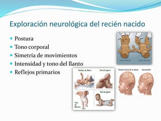 Exploración neurológica del recién nacido
 Postura
 Tono corporal
 Simetría de movimientos
 Intensidad y tono del llanto
 Reflejos primarios
 