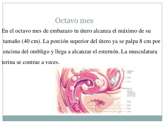 El emplasto del dolor en la espalda los tipos