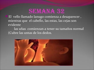 Semana 32
El vello llamado lanugo comienza a desaparecer ,
mientras que el cabello, las estas, las cejas son
evidente
las uñas comienzan a tener su tamaños normal
(Cubre las untas de los dedos.
 