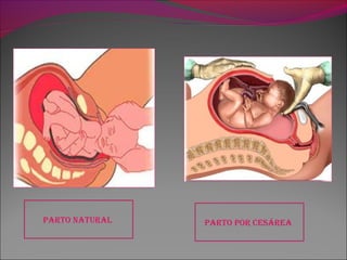 parTo naTural parTo por ceSárea
 