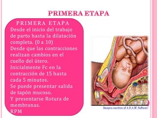 P R I M E R A E T A P A
Desde el inicio del trabajo
de parto hasta la dilatación
completa. (0 a 10)
Desde que las contracciones
realizan cambios en el
cuello del útero.
Inicialmente Fc en la
contracción de 15 hasta
cada 5 minutos.
Se puede presentar salida
de tapón mucoso.
Y presentarse Rotura de
membranas.
RPM
 
