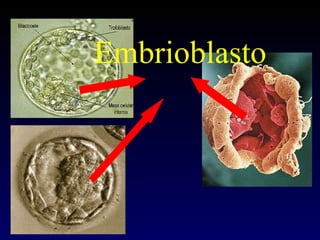 Embrioblasto 