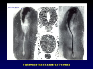 Fechamento total só a partir da 4ª semana 