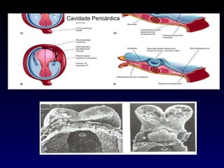 Cavidade Pericárdica 