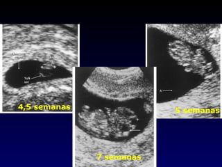 4,5 semanas 5 semanas 7 semanas 