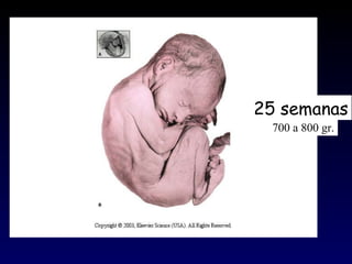 25 semanas 700 a 800 gr. 