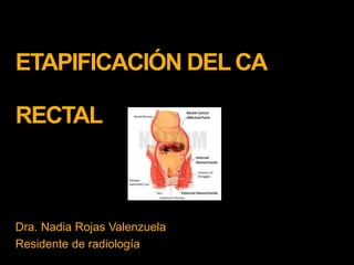ETAPIFICACIÓN DEL CA
RECTAL
Dra. Nadia Rojas Valenzuela
Residente de radiología
 