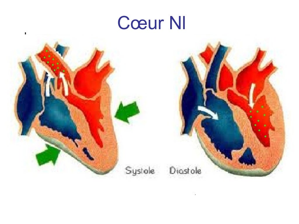 Etat de choc cardiogénique Tizi Etat de choc cardiogénique Tizi
