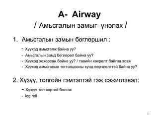 A- Airway
/ Амьсгалын замыг үнэлэх /
1. Амьсгалын замын бөглөршил :
- Хүүхэд амьсгалж байна уу?
- Амьсгалын замд бөглөрөл байна уу?
- Хүүхэд хөхөрсөн байна уу? / төвийн хөхрөлт байгаа эсэх/
- Хүүхэд амьсгалын тогтолцооны хүнд өөрчлөлттэй байна уу?
2. Хүзүү, толгойн гэмтэлтэй гэж сэжиглэвэл:
- Хүзүүг тогтвортой болгох
- log roll
11
 