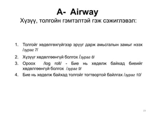 A- Airway
Хүзүү, толгойн гэмтэлтэй гэж сэжиглэвэл:
1. Толгойг хөдөлгөхгүйгээр эрүүг дарж амьсгалын замыг нээх
/зураг 7/
2. Хүзүүг хөдөлгөөнгүй болгох /зураг 8/
3. Ороох /log roll/ - Бие нь хөдөлж байхад биеийг
хөдөлгөөнгүй болгох /зураг 9/
4. Бие нь хөдөлж байхад толгойг тогтвортой байлгах /зураг 10/
19
 