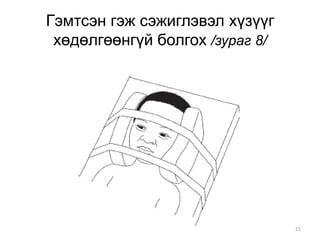 21
Гэмтсэн гэж сэжиглэвэл хүзүүг
хөдөлгөөнгүй болгох /зураг 8/
 