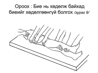 22
Ороох : Бие нь хөдөлж байхад
биеийг хөдөлгөөнгүй болгох /зураг 9/
 