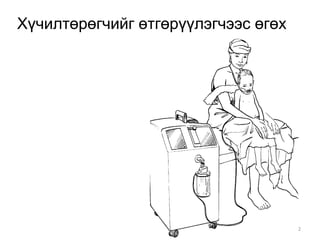 29292299292929292929292
Хүчилтөрөгчийг өтгөрүүлэгчээс өгөх
 