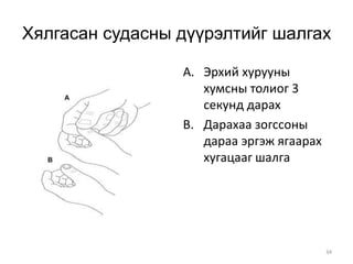34
Хялгасан судасны дүүрэлтийг шалгах
A. Эрхий хурууны
хумсны толиог 3
секунд дарах
B. Дарахаа зогссоны
дараа эргэж ягаарах
хугацааг шалга
 