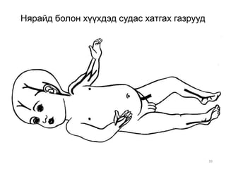 39
Нярайд болон хүүхдэд судас хатгах газрууд
 
