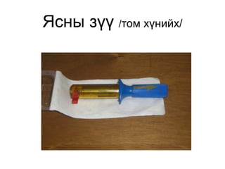 Ясны зүү /том хүнийх/
 