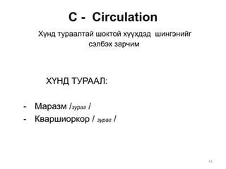 С - Circulation
Хүнд тураалтай шоктой хүүхдэд шингэнийг
сэлбэх зарчим
ХҮНД ТУРААЛ:
- Маразм /зураг /
- Кваршиоркор / зураг /
41
 
