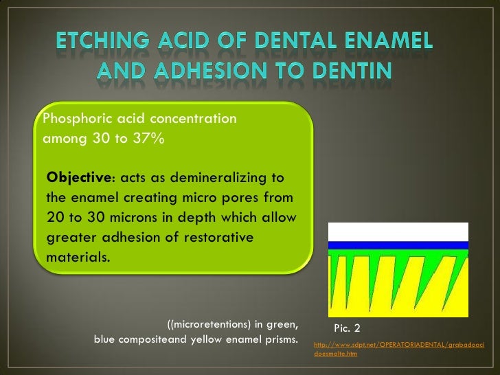 Etchant in dentistry