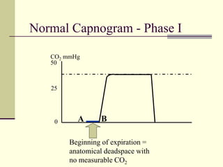 Normal Capnogram - Phase I
50
0
25
CO2 mmHg
Beginning of expiration =
anatomical deadspace with
no measurable CO2
A B
 