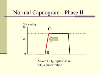 Normal Capnogram - Phase II
50
0
25
CO2 mmHg
Mixed CO2, rapid rise in
CO2 concentration
B
C
 