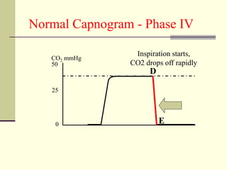 Normal Capnogram - Phase IV
50
0
25
CO2 mmHg
Inspiration starts,
CO2 drops off rapidly
E
D
 