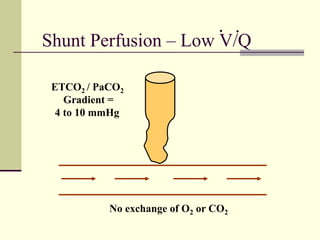 Shunt Perfusion – Low V/Q
No exchange of O2 or CO2
ETCO2 / PaCO2
Gradient =
4 to 10 mmHg
. .
 
