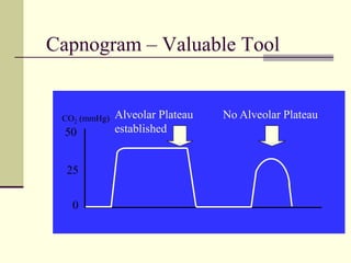 Capnogram – Valuable Tool
CO2 (mmHg)
0
25
50
Alveolar Plateau
established
No Alveolar Plateau
 