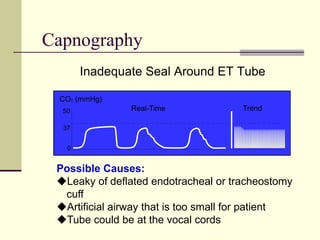 Capnography
Inadequate Seal Around ET Tube
Possible Causes:
Leaky of deflated endotracheal or tracheostomy
cuff
Artificial airway that is too small for patient
Tube could be at the vocal cords
CO (mmHg)
2
0
37
50 Real-Time Trend
 