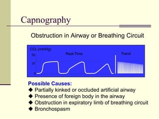 Capnography
Obstruction in Airway or Breathing Circuit
Possible Causes:
 Partially kinked or occluded artificial airway
 Presence of foreign body in the airway
 Obstruction in expiratory limb of breathing circuit
 Bronchospasm
CO (mmHg)
2
0
37
50 Real-Time Trend
 