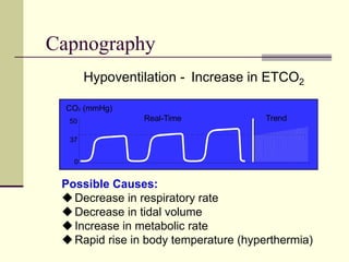 Capnography
Hypoventilation - Increase in ETCO2
Possible Causes:
Decrease in respiratory rate
Decrease in tidal volume
Increase in metabolic rate
Rapid rise in body temperature (hyperthermia)
CO (mmHg)
2
0
37
50 Real-Time Trend
 