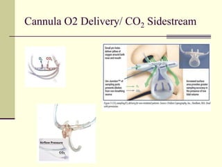 Cannula O2 Delivery/ CO2 Sidestream
 