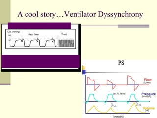 A cool story…Ventilator Dyssynchrony
 