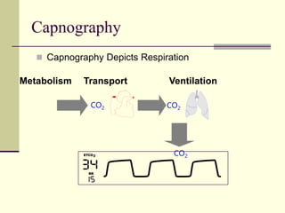  Capnography Depicts Respiration
Capnography
Metabolism Transport Ventilation
CO2 CO2
CO2
ETCO2
RR
 