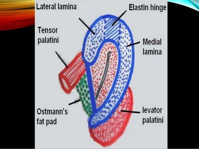 How do you lose fat off your bum image 2