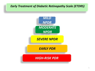 Early Treatment of Diabetic Retinopathy Scale (ETDRS)
MILD
NPDR
MODERATE
NPDR
SEVERE NPDR
EARLY PDR
HIGH-RISK PDR
1
 