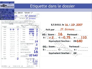 ETDRS en pratique