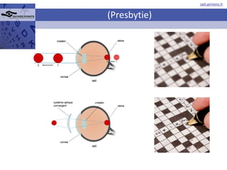 (Presbytie) 