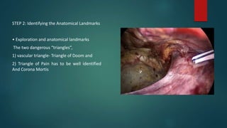 STEP 2: Identifying the Anatomical Landmarks
• Exploration and anatomical landmarks
The two dangerous “triangles”,
1) vascular triangle- Triangle of Doom and
2) Triangle of Pain has to be well identified
And Corona Mortis
 