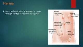 Hernia
 Abnormal protrusion of an organ or tissue
through a defect in its surrounding walls
 