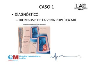 CASO 1 
•  DIAGNÓSTICO:  
  – TROMBOSIS DE LA VENA POPLÍTEA MII. 
 